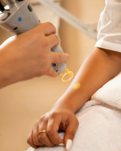 health practitioner hand giving laser skin treatment to client arm